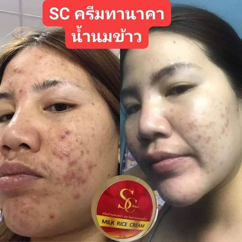 ครีมscทานาคานมข้าวขนาด15g