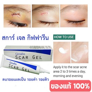 ทาเจลทุกวันรอยแผลหายไวสการ์เจลScar Gelเจลลบรอยแผลเป็นรอยดำรอยสิว/ปริมาณ15กรัม/1หลอด/รหัส14005📌ของแท้100%