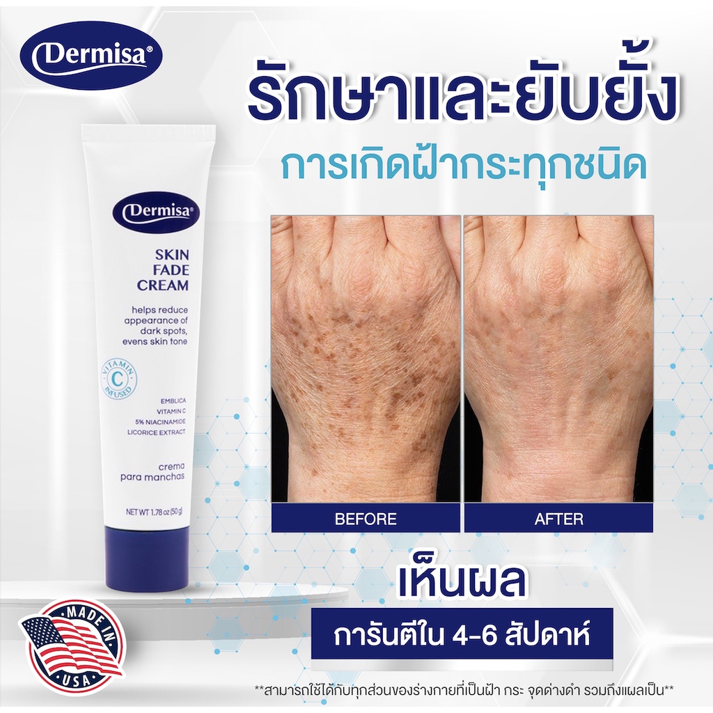 dermisa-skin-fade-cream-50-g-ครีมลดฝ้า-กระ-จุดด่างดำ-จาก-usa