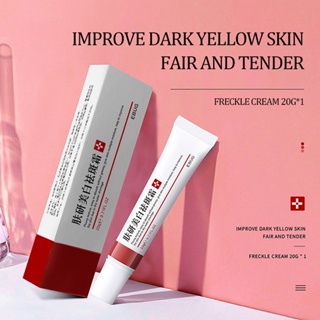 Yiluying 1PC Effective Whitening Freckle Cream Remove Dark Spots Anti Freckle Cream Niacinamide Fade Pigmentation Melasma Brighten Cream Skin Care