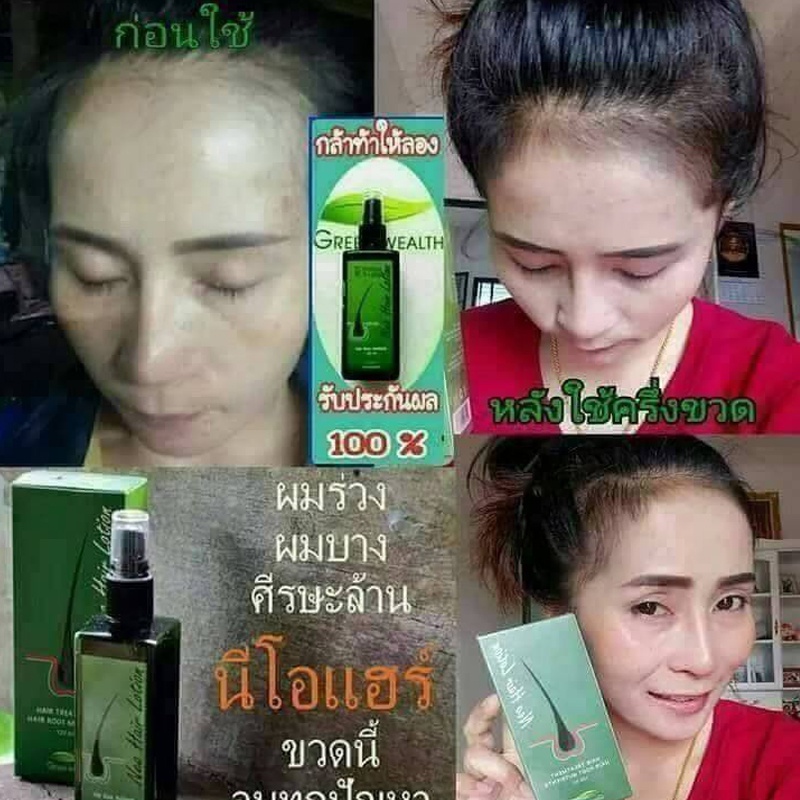 นีโอแฮร์-โลชั่น-1ขวด-ผลิตภัณฑ์บำรุงรากผม-และ-หนังศีรษะ-neo-hair-lotion