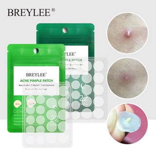 10 Pcs Of Acne Acne Patch Acne Treatment Acne Removal Tool Spot Mask Skin Repair Hydrating 22 Patches