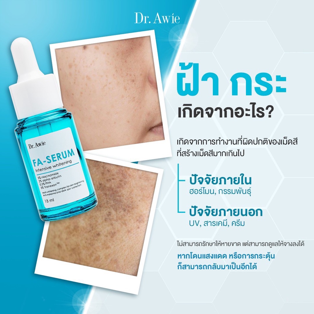 fa-serum-5-ขวด-เซรั่มขวดฟ้าแก้ฝ้า-ฝ้า-กระ-จุดด่างดำ-รอยดำสิว-ด้วยนวัตกรรมแก้ฝ้า-3-ขั้นตอน-อ่อนโยนต่อผิว