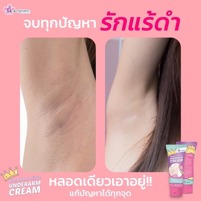 ส่งฟรี-ของแท้-กังนัม-ครีมกังนัม-gangnam-clinic-underarm-cream-ทารักแร้ขาว-ครีมรักแร้ขาว-กังนัมคลินิก-ลดกลิ่น-ลดเหงื่อ