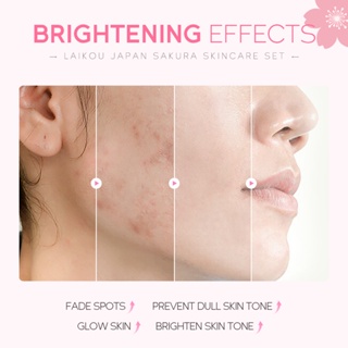 ภาพขนาดย่อของภาพหน้าปกสินค้าLAIKOU Japan Sakura Skin Care Set Brighten Skin Tone Nourishing Moisturizing Skincare 5pcs/Set จากร้าน laikou.thailand บน Shopee ภาพที่ 5
