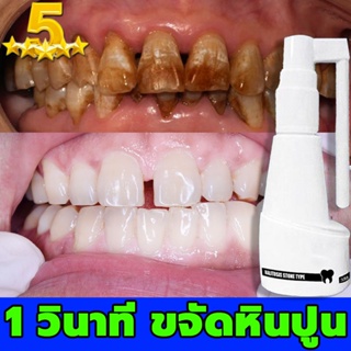 ฟอกฟันขาว สเปรย์ 30ml ลดคราบฟันเฟลือง หินปูน กลิ่นปาก เหงือกบวม เสียวฟัน  น้ำยาขจัดคราบฟัน ฟอกสีฟัน