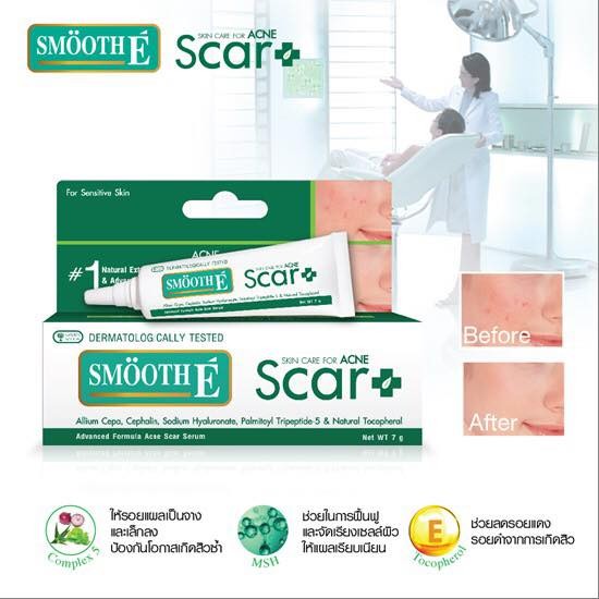 smooth-e-acne-scar-serum-7-g-เจลลบรอยแผลเป็นจากสิว-สมูทอี-1192446