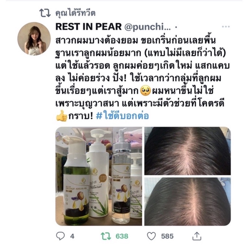 ภาพสินค้าเซ็ตกลางDT(Detox) หนังศรีษะมัน+เคราตินแฮร์เซรั่ม ผมร่วง-ผมบาง สูตร2 จากร้าน sweety_club77 บน Shopee ภาพที่ 1