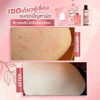 ภาพขนาดย่อของภาพหน้าปกสินค้าBody oil ถุงมือขัดขี้ไคล + ออยทาผิว Soluxe ชุดสปาผิว 690 บาท จัดส่งทุกวัน ไวมา  ชุดสครับผิว จากร้าน mickeythim บน Shopee