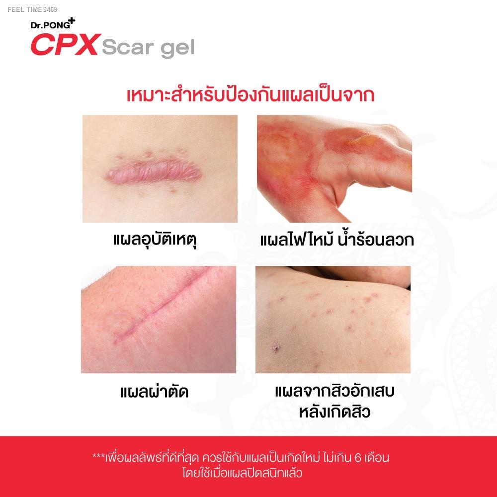 ส่งไวจากไทย-dr-pong-cpx-scar-gel-เจลซิลิโคนทางการแพทย์-ลดเลือนป้องกันรอยแผลเป็น