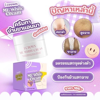 ครีมแอนนา  I Crown Me White Cream ไอเคราน์มีไวท์ครีม ของแท้ ขาหนีบดำ รักแร้ดำ ขนาด 30 กรัม พร้อมส่ง