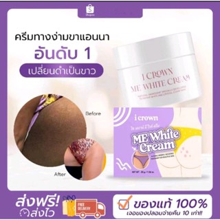 [ ของแท้ 💯 ]  I CROWN ME WHITE CREAM ครีมแอนนา ครีมทาง่ามขาแอนนา ครีมทาขาหนีบ ครีมทาขาหนีบดำ