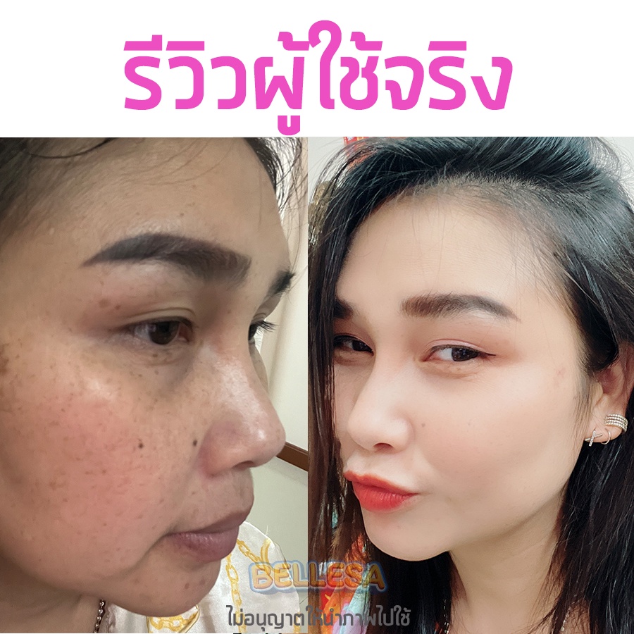 วิตามินผิวขาว-2แถม1-วิตามิน-กลูต้า-คอลลาเจน-ปรับผิวขาวใสไว-ผิวขาวเร่งด่วน-ผิวออร่า-ผิวแข็งแรง-ฉ่ำน้ำดูสุขภาพดี