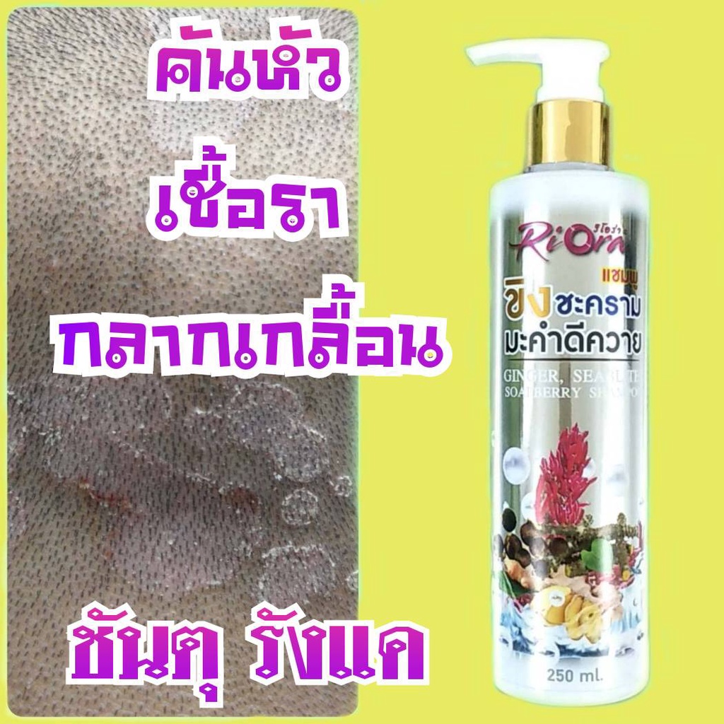 แชมพู-ริโอร่า-riora-ขิงชะครามมะคำ-แชมพูสูตรโบราณ-สำหรับคันศีรษะ-รังแค-ชันตุ-กลากเกลื้อน-เชื้อรา-บนหนังศีรษะ