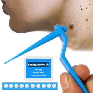 ภาพหน้าปกสินค้าอุปกรณ์กำจัดหูด ไฝ ติ่งเนื้อ หลุดออกอย่างง่ายดาย Medical Skin Tag Kill Remover ไม่ต้องใช้ เครื่องจี้ไฝ แท็กกําจัดไฝ ไฝ บนใบหน้า พร้อมแผ่นทําความสะอาด สําหรับผู้ใหญ่ ที่เกี่ยวข้อง