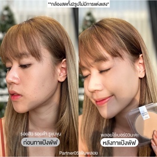 ภาพขนาดย่อของภาพหน้าปกสินค้าโปรจอง1แถม1 แป้งพัฟลดสิวสูตรคุณหมอ แป้งพัฟลานอส จากร้าน pimploy.store บน Shopee