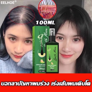 เซรั่มปลูกผม สเปรย์​ เร่งผมยาว ลดหลุดร่วง ปลูกผม แก้ผมบาง แก้ผมร่วง ขจัด​รังแค​ บำ​รุง​ศีรษะ​ 100มล. 1ขวด