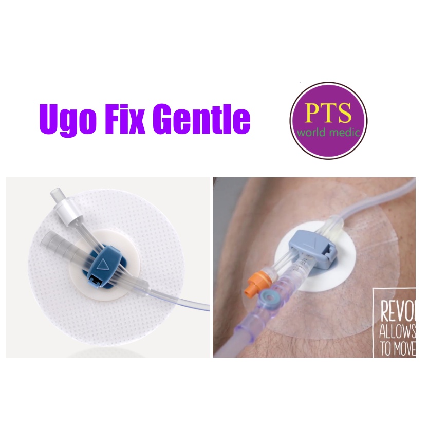 Ugo Fix Gentle แผ่นยึดติดสายสวนปัสสาวะ (1 ซอง) | Shopee Thailand