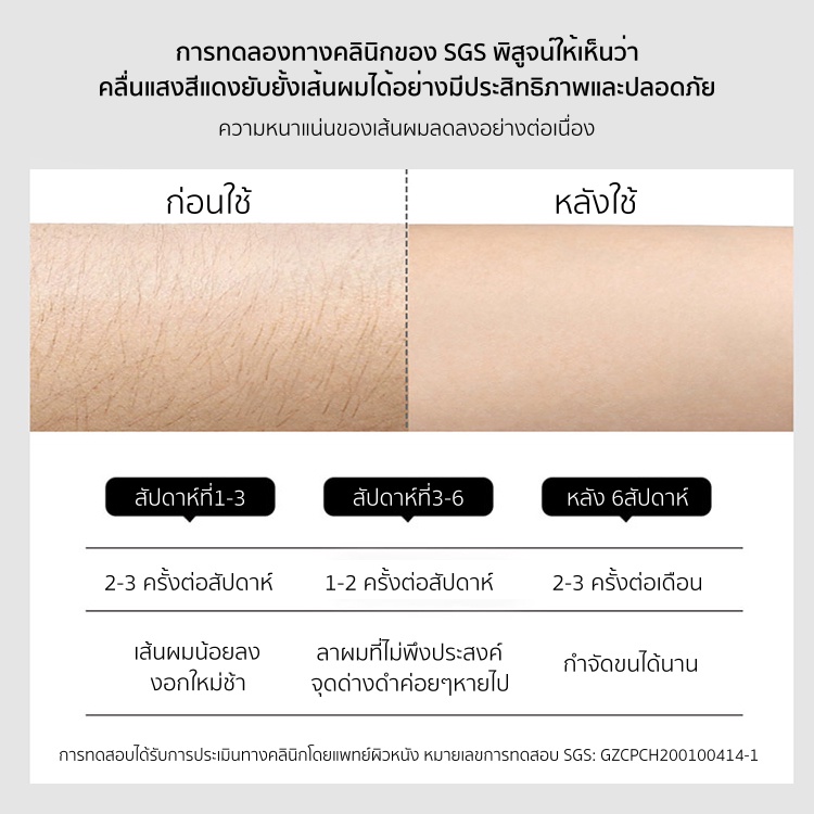 ผ่อน10เดือน-amiro-a1-เครื่องกำจัดขน-ipl-ระบบเย็น-คลื่นแสงสีแดง-ไม่เจ็บ-พร้อม-เลเซอร์ผิวหน้า-เครื่องเลเซอร์กำจัดขน-เลเซอ