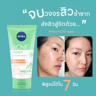 Nivea acne repair โฟมล้างหน้าสำหรับคนเป็นสิวและผิวแพ้ง่าย วิธีรักษาสิวที่ทุกคนอยากบอกต่อ ขนาด90ml