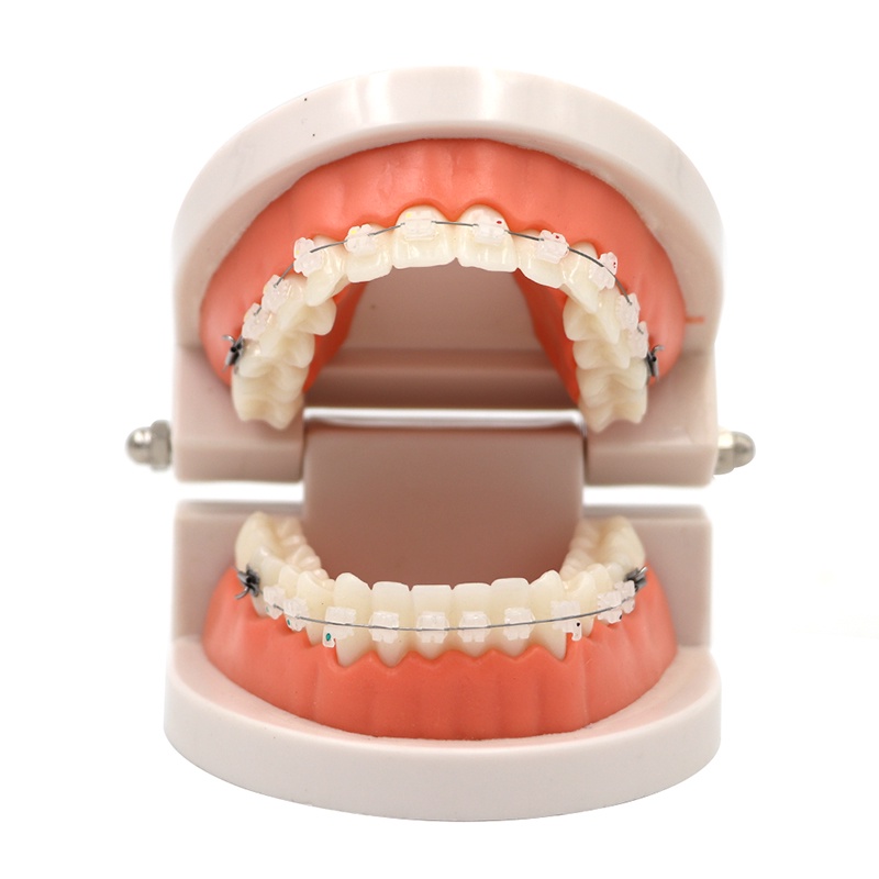 Dental Orthodontic Treatment Model With Ortho Metal Ceramic Bracket