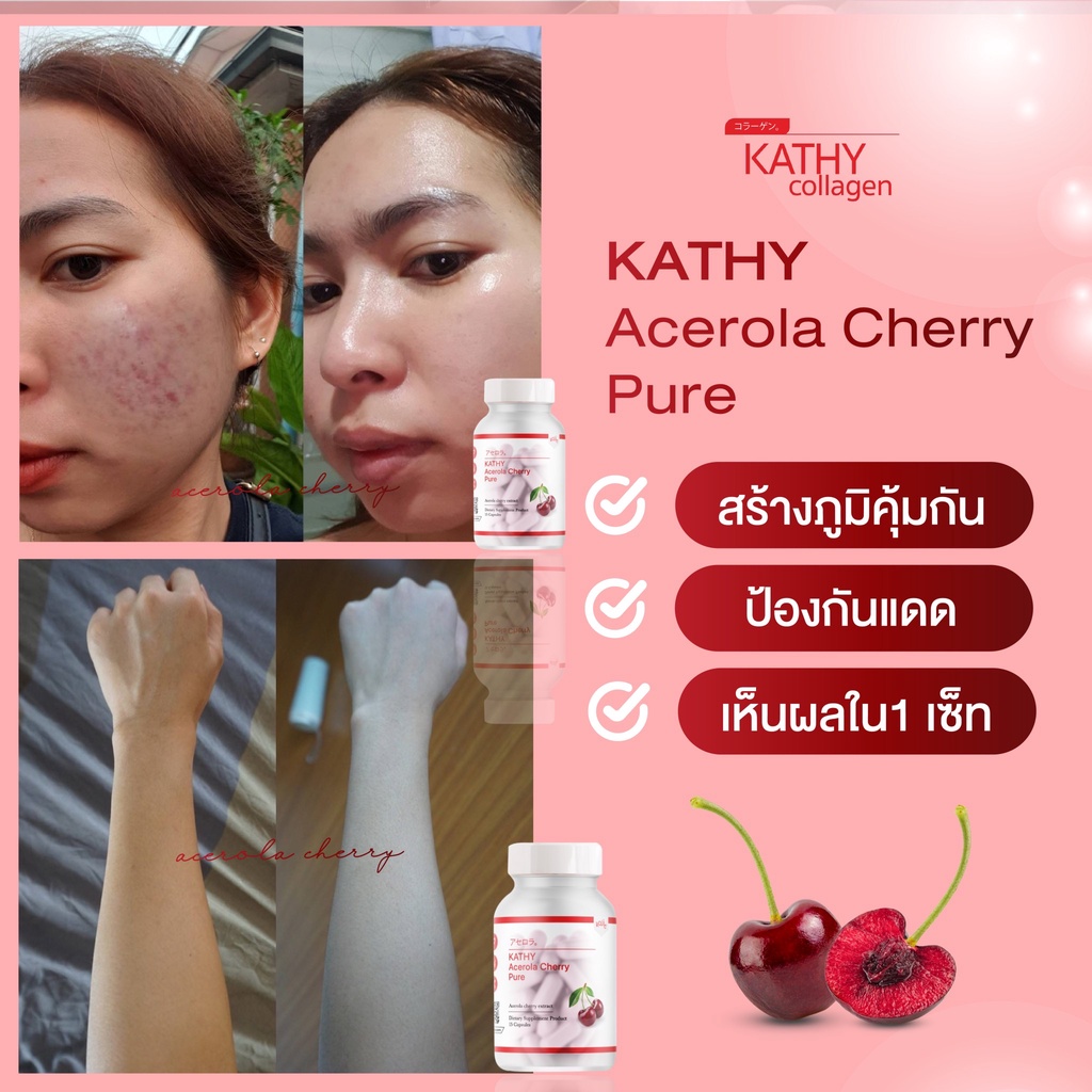 ส่งฟรี-10-แถม-10-อะเซโรล่าเชอรี่-acerola-cherry-pure-504mg-ส่งไว-มีชำระปลายทาง