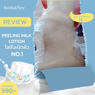 Peeling Milk Lotion โลชั่นลอกผิวกาย