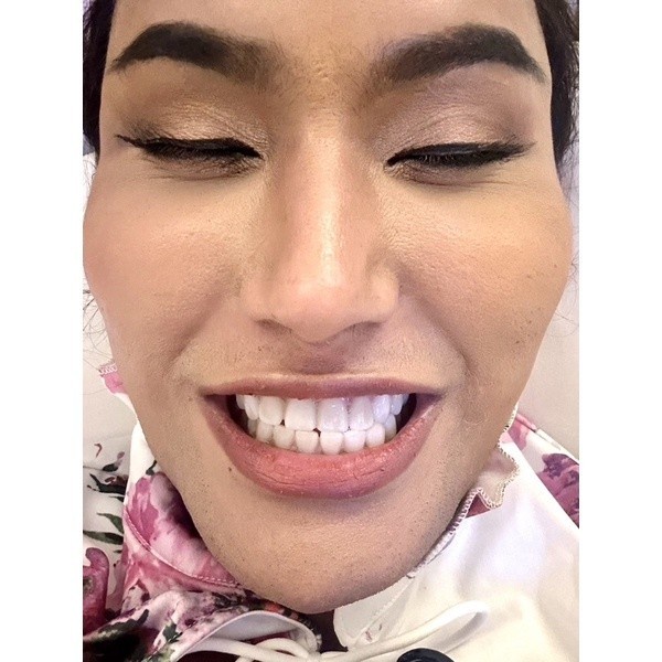 ตลับชมพู-white-teeth-powder-ผงฟอกฝันขาว-bwhite-ฟอกฟันแอนนา