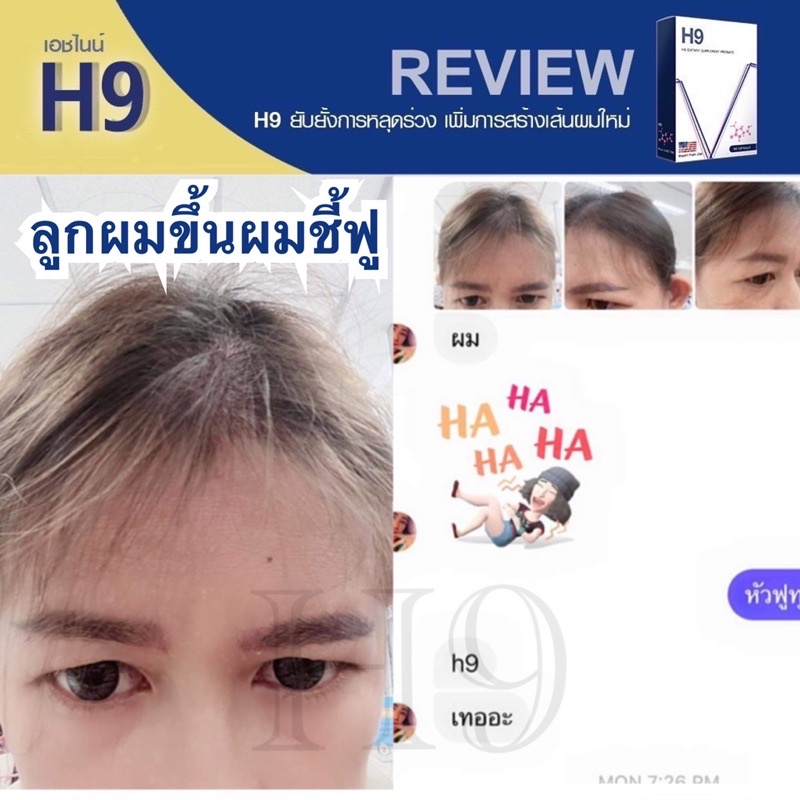 วิตามินลดผมร่วง-h9-ไบโอตินกระตุ้นรากผม-หนาขึ้น-รากผมแข็งแรง-ขนาด-60-เม็ด