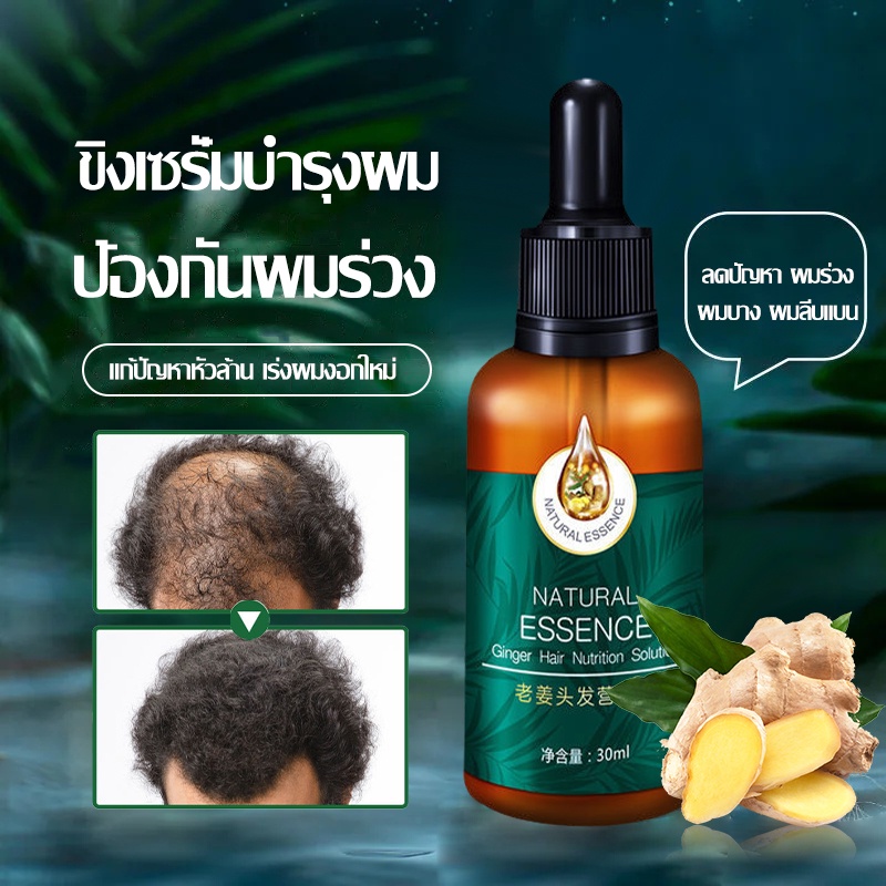 เซรั่มบำรุงผม-สารสกัดจากขิง-น้ำยาปลูกผม-เซรั่มปลูกผม-ginger-hair-essence-ซ่อมแซมผมเสีย-เร่งผมยาว-ป้องกันผมร่วง-718