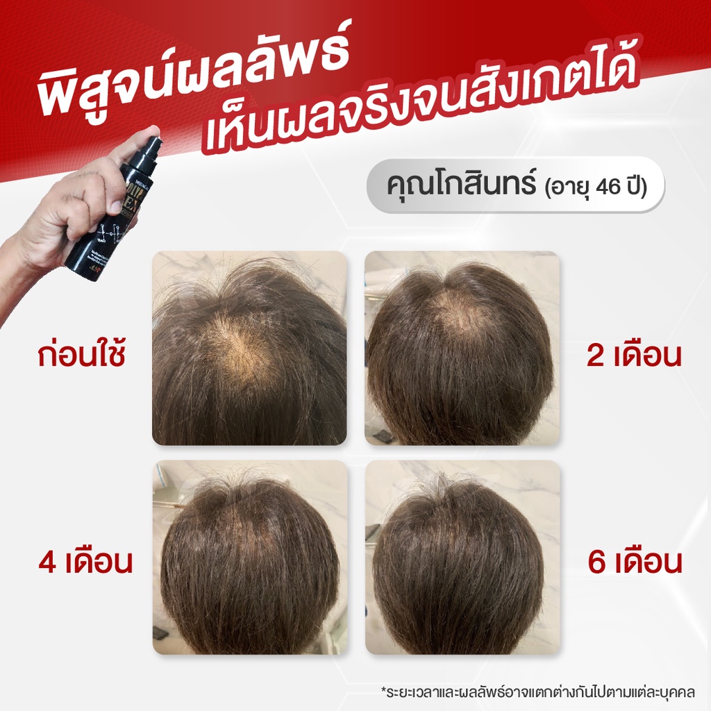 polypure-shampoo-โพลีเพียว-แชมพู-350ml-แชมพูลดผมร่วง-ปลูกผม-ญี่ปุ่น-ยาสระผม-บำรุงผม-ลดรังแค-ลดผมหงอก-ลดคัน-3-ขวด