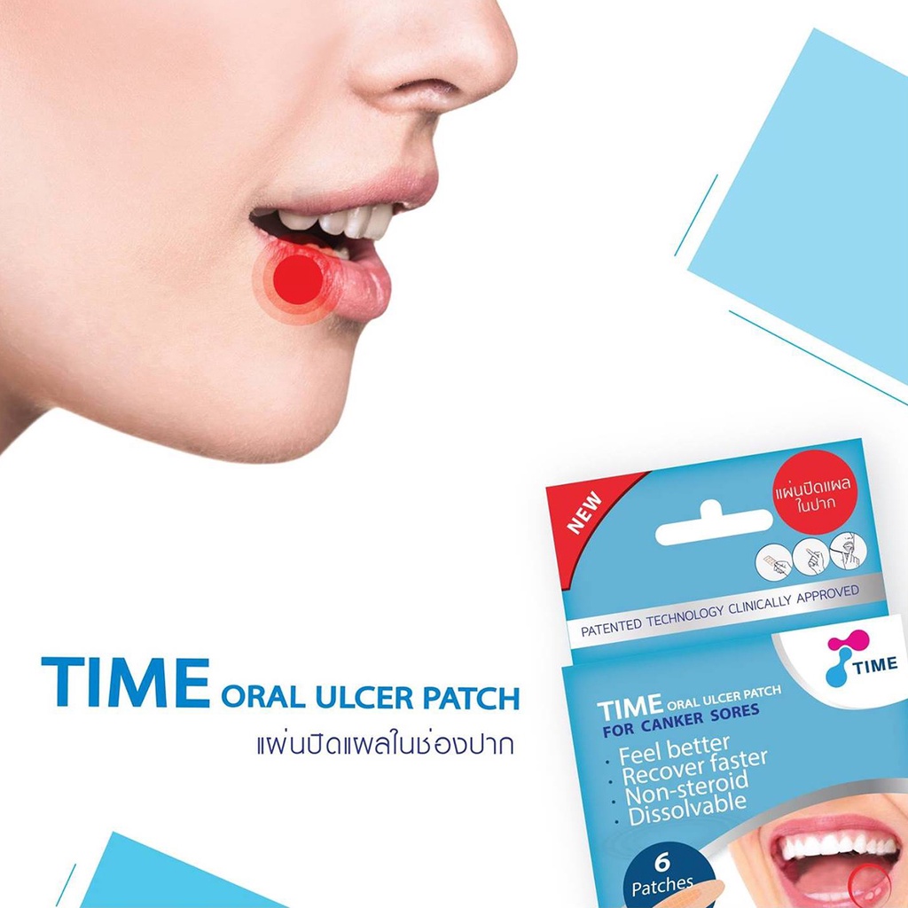 time-oral-ulcer-patch-แผ่นปิดแผลในปาก-ผลร้อนใน-แผลกัดหรือกระแทก-1-กล่อง-6-แผ่น