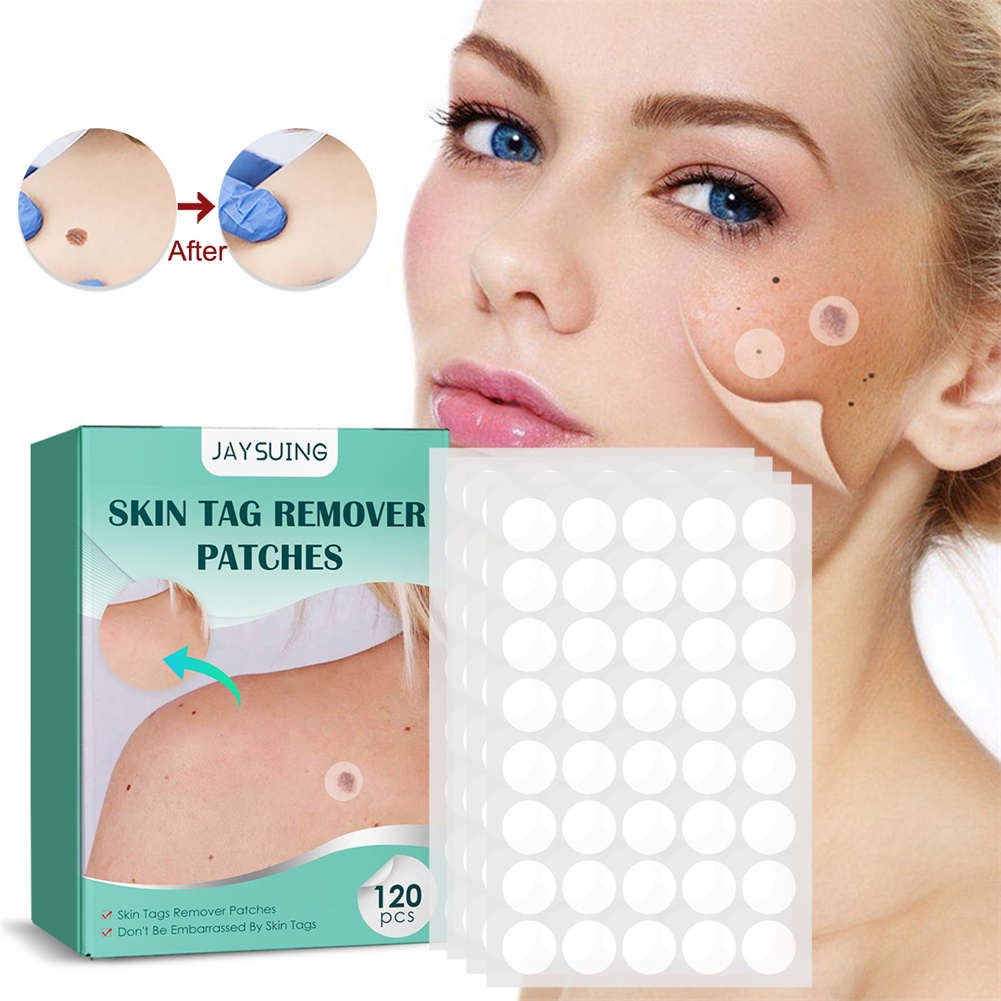 julystar-jaysuing-120-pcs-skin-tags-patches-กำจัดปลอดภัยไม่เจ็บปวด-acne-wart-removal-patches-ชุดดูแลผิว-antibacterial-patch-natural-gentle-บรรเทาอาการปวด