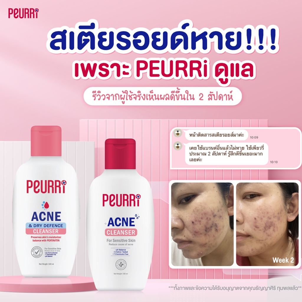 ถูก-ของแท้-เจลล้างหน้า-amp-เจลแต้มสิว-เพียวรี-แอคเน่-จบทุกปัญหาสิว-peurri-acne-cleanser-peurri-anti-acne-gel