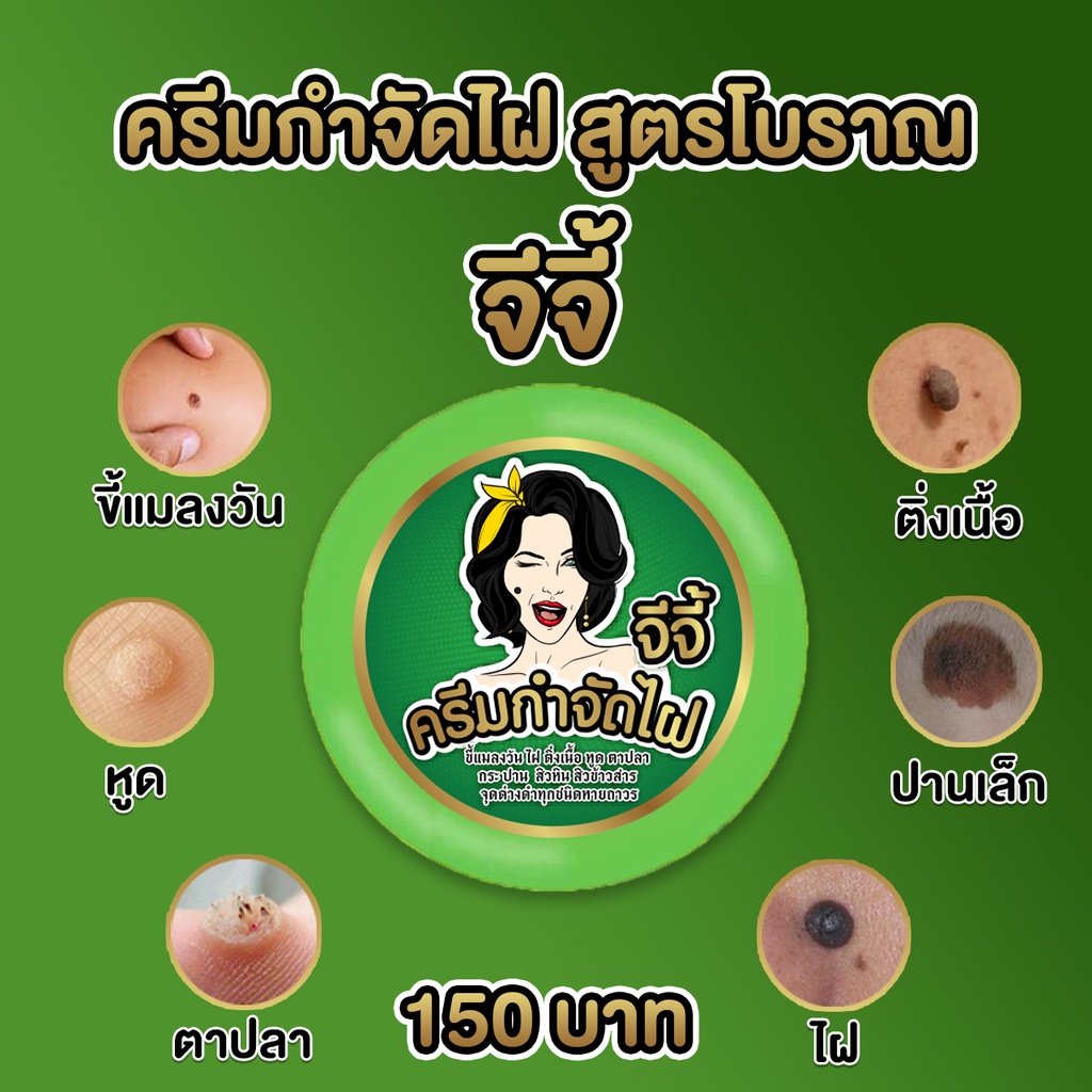 ครีมกำจัดไฝ-ขี้แมลงวันติ่งเนื้อ-หูด-ตาปลา-แก้ปัญหา-กระ-สิวหิน-รอยสัก-จีจี้