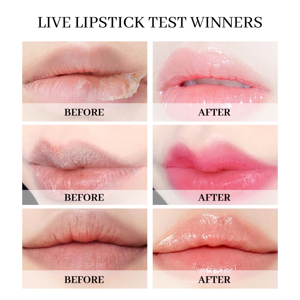 alu286-vaseline-lip-balm-การดูแลสุขภาพความงาม-ดูแลริมฝีปาก-ลิปบาล์ม-ให้ความชุ่มชื้นให้ความชุ่มชื้น-ลดริ้วรอยริมฝีปาก-ลิปสติกฟิล์มริมฝีปาก