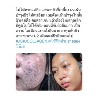 ภาพขนาดย่อของภาพหน้าปกสินค้าพร้อมส่ง ️JOJU COLLAGEN โจจูคอลลาเจน ของแท้100% คอลลาเจนแบบเคี้ยว ผิวใส ลดสิว ผิวขาว จากร้าน rodmay.official บน Shopee ภาพที่ 6