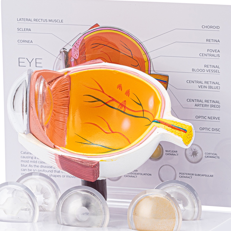 cornea-โมเดลลูกตามนุษย์-พร็อพการสอนกายวิภาคศาสตร์