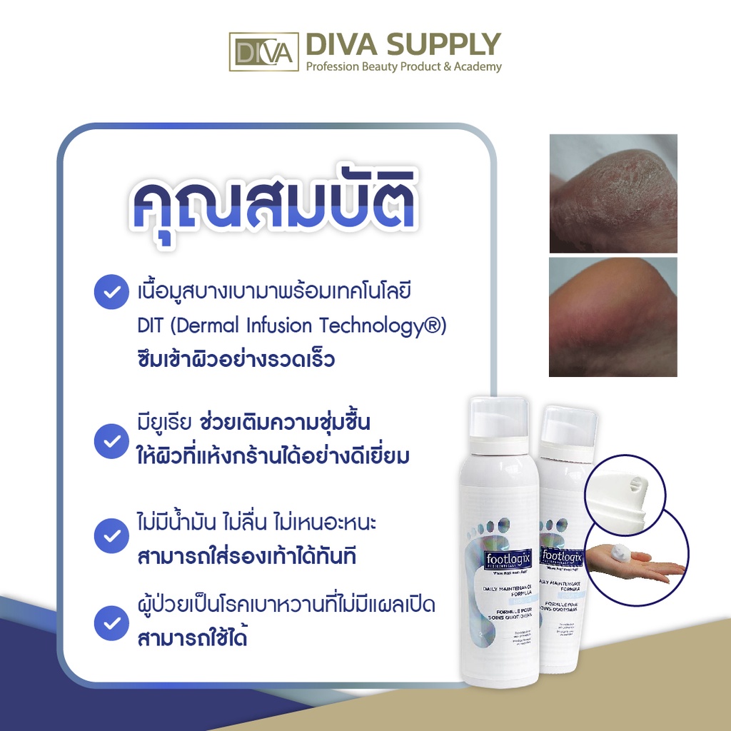 footlogix-มูสบำรุงส้นเท้าแห้ง-ครีมบำรุงเท้า-ลดส้นเท้าแตก-ส้นเท้าด้าน-เพิ่มความชุ่มชื้น-เห็นผลทันทีfootlogix-2