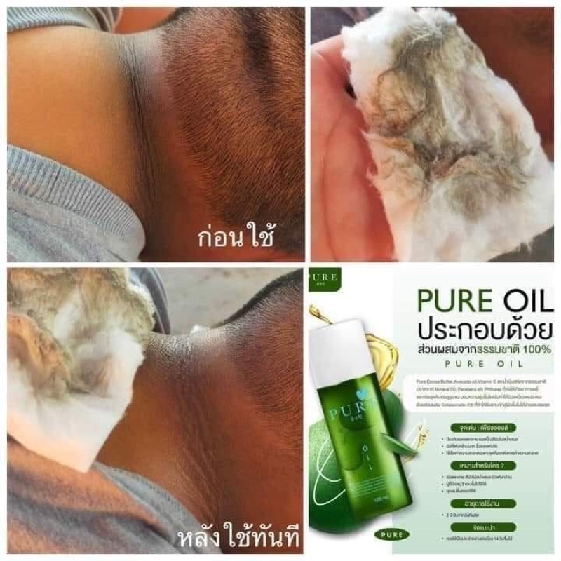 pure-oil-เพียวออยล์-ขนาด-100-ml-ใช้ได้-2-เดือน