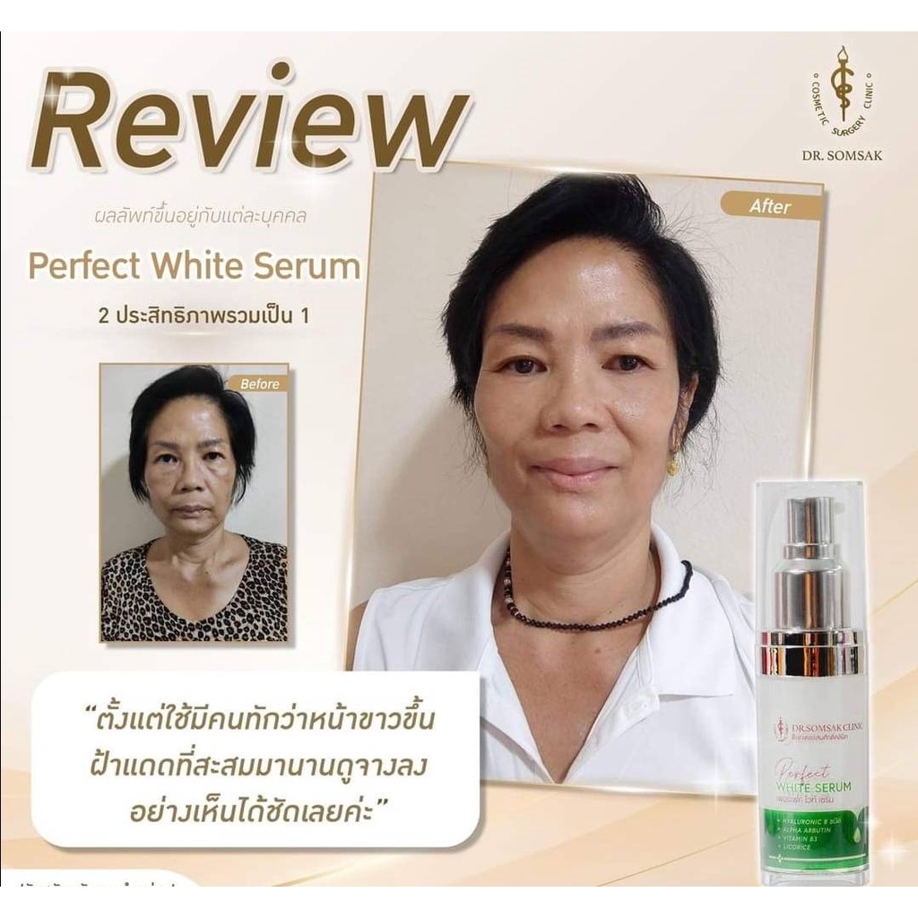 เพอร์เฟค-ไวท์-ซีรั่ม-perfect-white-serum-ไม่ดี-หมอไม่ทำ-เริสที่สู๊ดดดด-ผลงานของไวท์เซรั่ม-ลดก็ฝ้าได้-ลดริ้วรอยได้