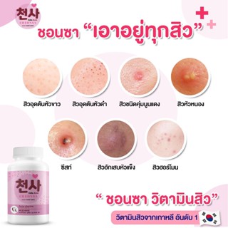 📣FLASH SALE 🔥 [ซื้อ 3 FREE 1] 천사 CHEONSA Colla Acne วิตามินลดสิว เอาอยู่ทุกสิว คืนผิวสวยใส ออร่า ขาวขึ้นX2 ผิวเกาหลี100%