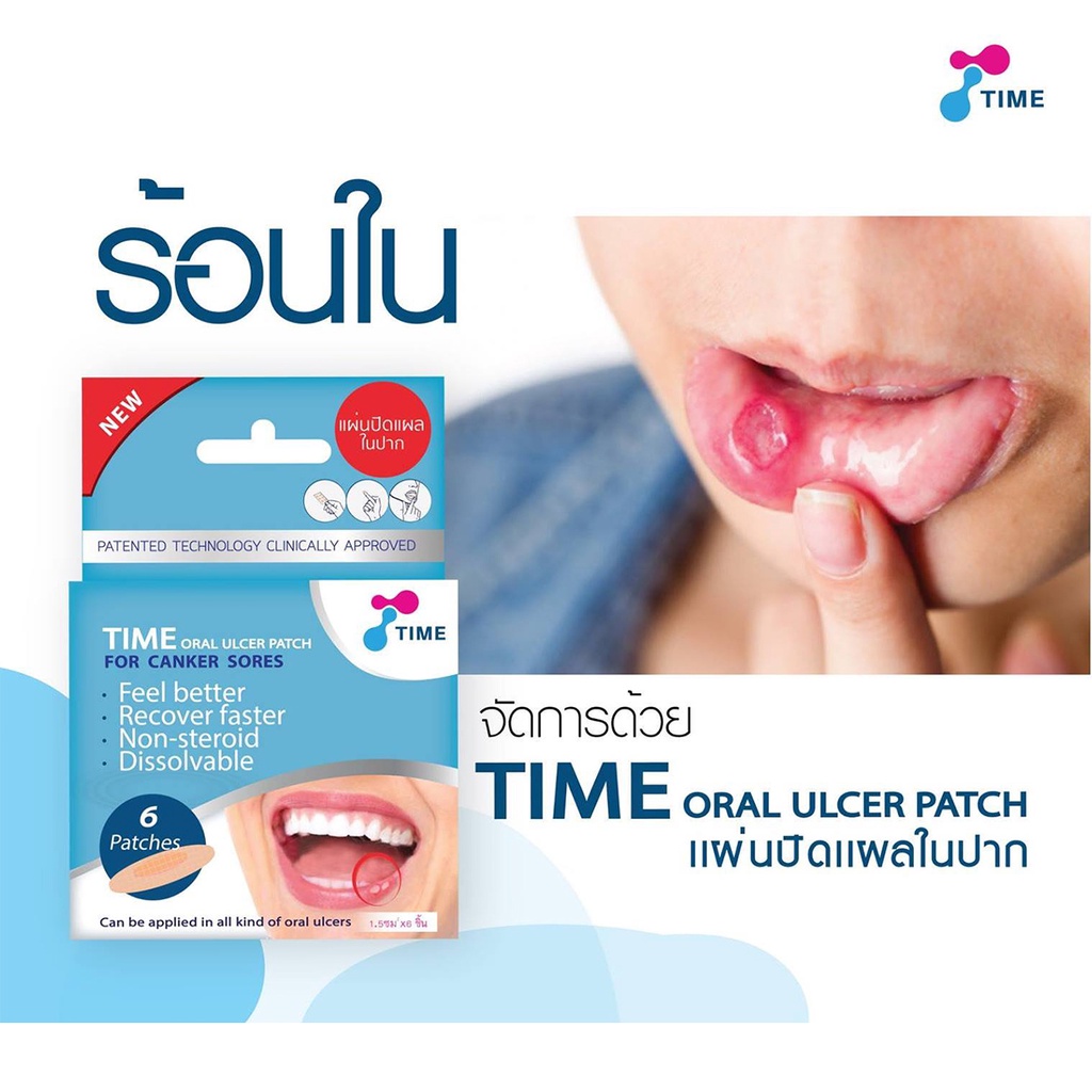 time-oral-ulcer-patch-แผ่นปิดแผลในปาก-ผลร้อนใน-แผลกัดหรือกระแทก-1-กล่อง-6-แผ่น