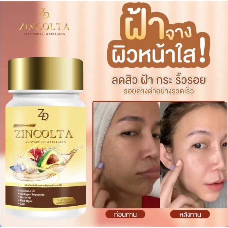 2-แถม-1-แค่-1000-เท่านั้น-zincolta-ซินคลอต้า-ของแท้จากบริษัทแน่นอน-ทานเองจ้าาา