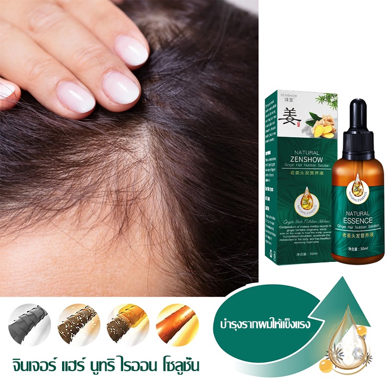 เซรั่มบำรุงผม-สารสกัดจากขิง-น้ำยาปลูกผม-เซรั่มปลูกผม-ginger-hair-essence-ซ่อมแซมผมเสีย-เร่งผมยาว-ป้องกันผมร่วง-718