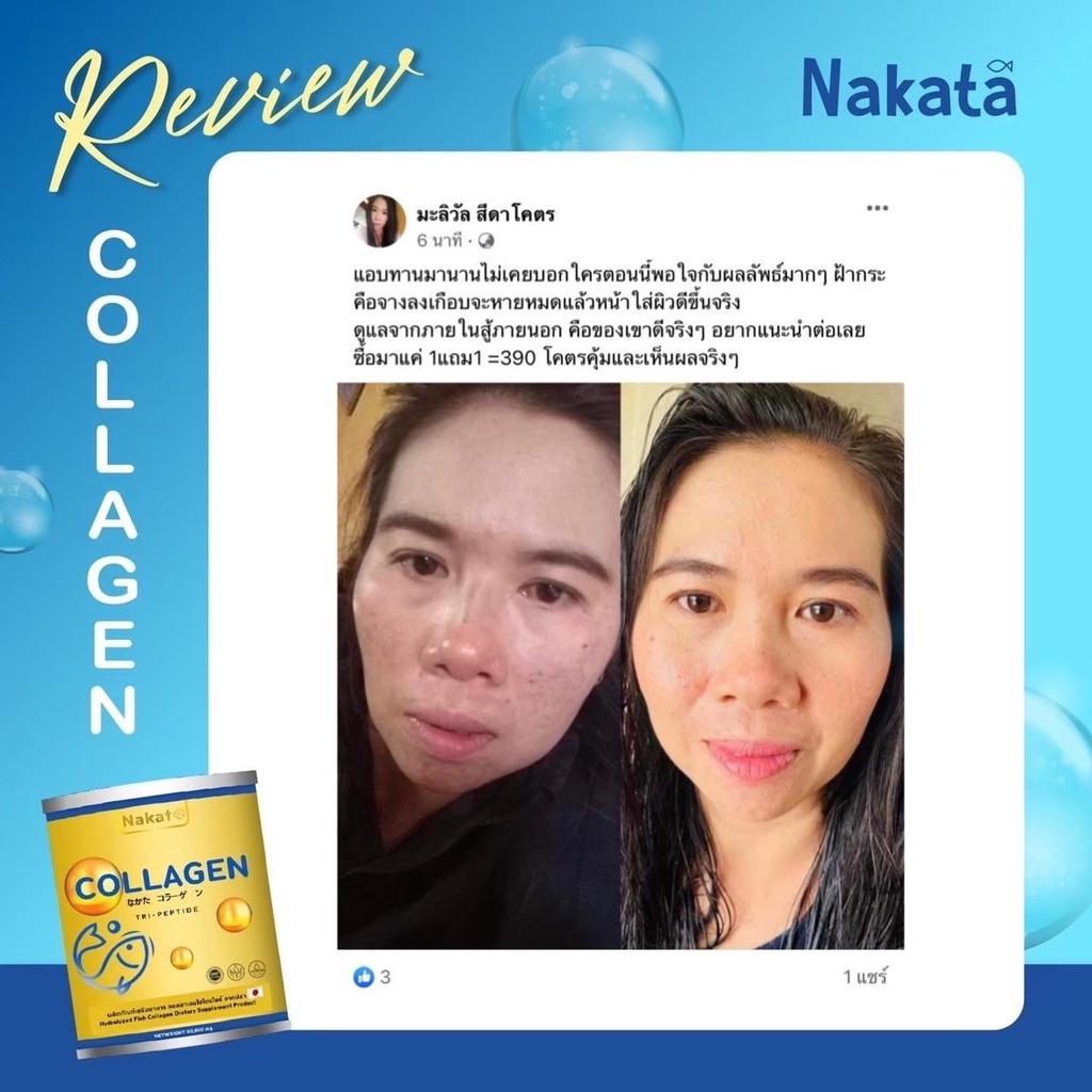 ภาพสินค้านาคาตะ 1แถม1 ส่งฟรี Nakata Collagen Tripeptide นาคาตะ คอลลาเจน เกรดพรีเมี่ยม แก้ปัญหา ผมร่วง ข้อ เข่า กระดูก จากร้าน panidrunda บน Shopee ภาพที่ 7