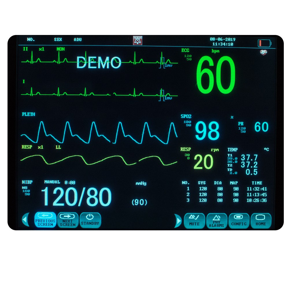 【สต็อกพร้อม】Portable Multi-parameter 12 Inch Vital Sign Patient Monitor ...