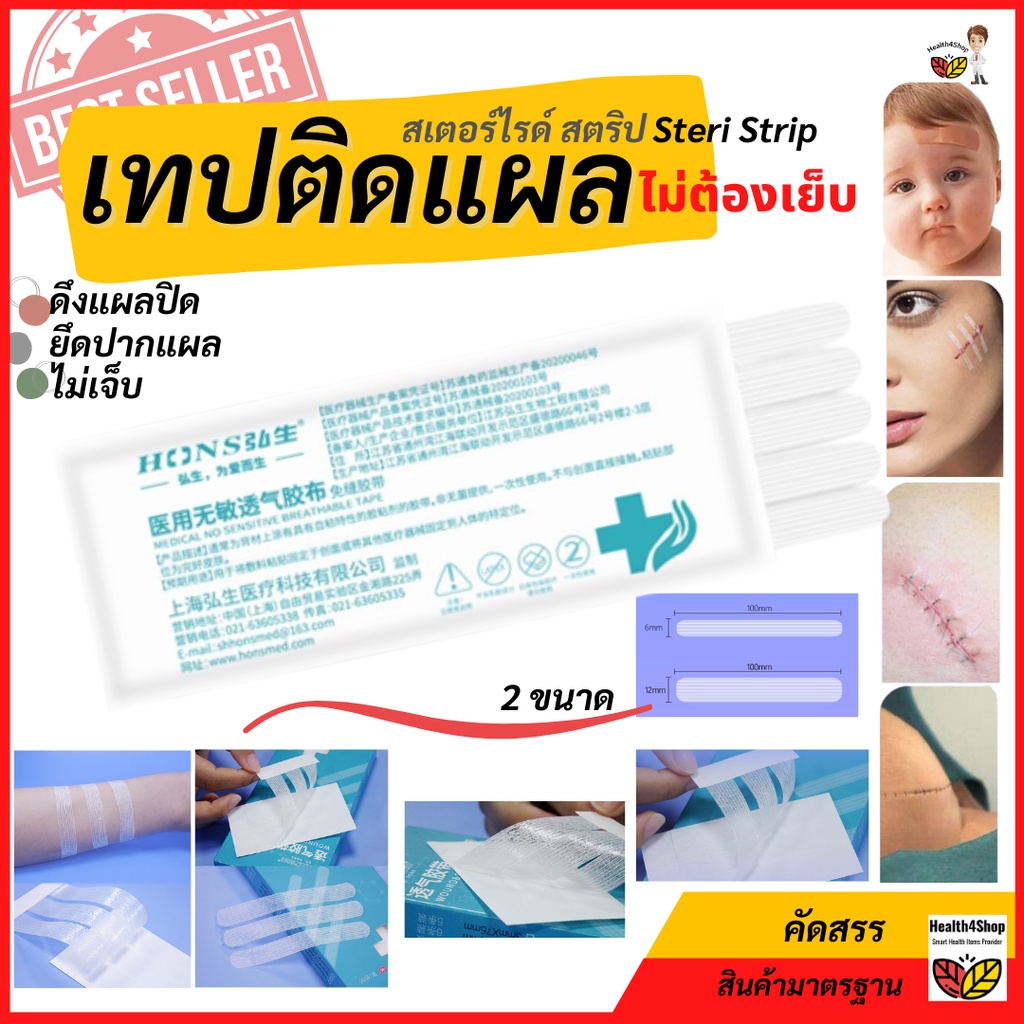 t7-เทปติดแผล-แผ่่นเทปติดแผล-สเตอร์ไรด์-สตริป-steri-strip-แผ่นปิดแผล-แทนการเย็บ-แผ่นเย็บแผล-ไม่ต้องเย็บ-ราคาต่อ-1-ซอง