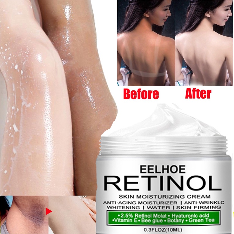 eelhoe-retinol-whitening-cream-underarm-whitening-cream-retinol-keeping-smooth-whitening-cream-สำหรับชิ้นส่วนส่วนตัว