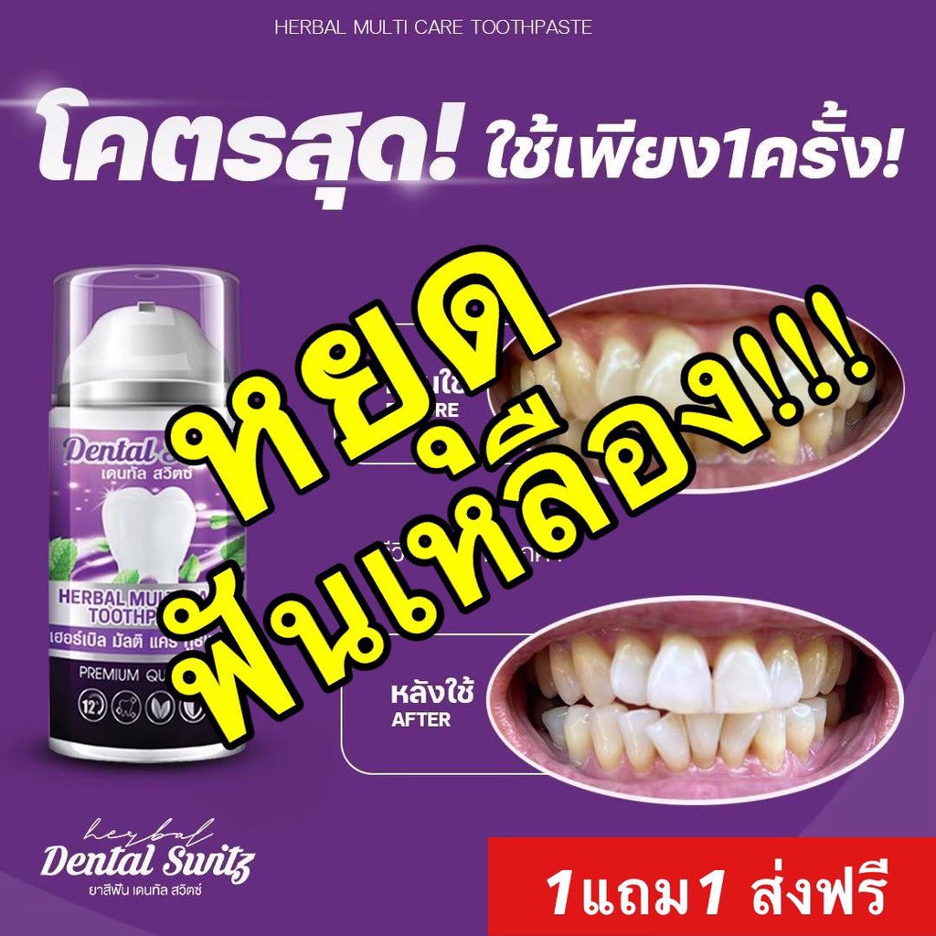 ส่งฟรี! 1แถม1 เจลฟอกฟันขาว เดนทัล สวิตซ์(Dental Switz) ช่วยให้ฟันขาว